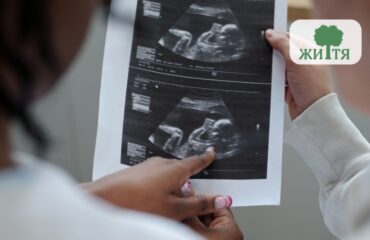 Chy mozhna chasto robyty UZD pid chas vahitnosti bezpeka dlya mamy y dytyny Two people hold a printed ultrasound image showing a fetus, with a logo in the top-right corner.