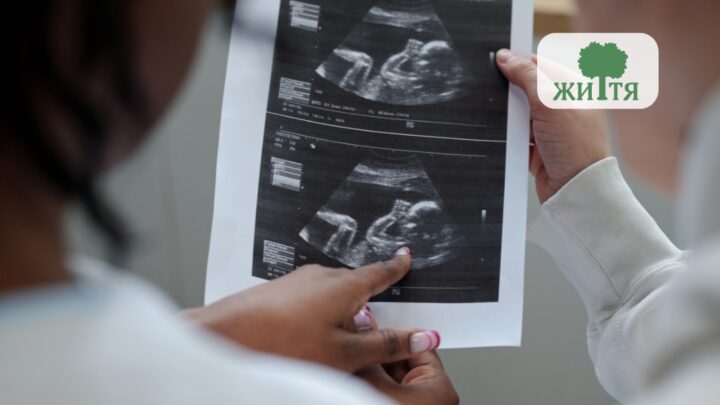 Two people hold a printed ultrasound image showing a fetus, with a logo in the top-right corner.