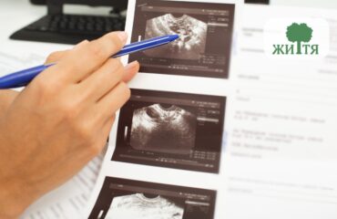 Folikulometriya koly roblyat UZD na ovulyatsiyu i shcho vono pokazuye Close-up of a hand with a blue pen pointing at ultrasound images on a printed sheet with a medical logo in the corner