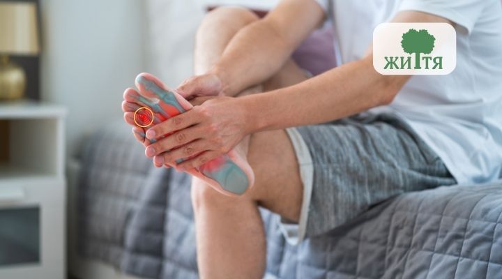 Nevroma Mortona chomu vynykaye bil u peredniy chastyni stopy
